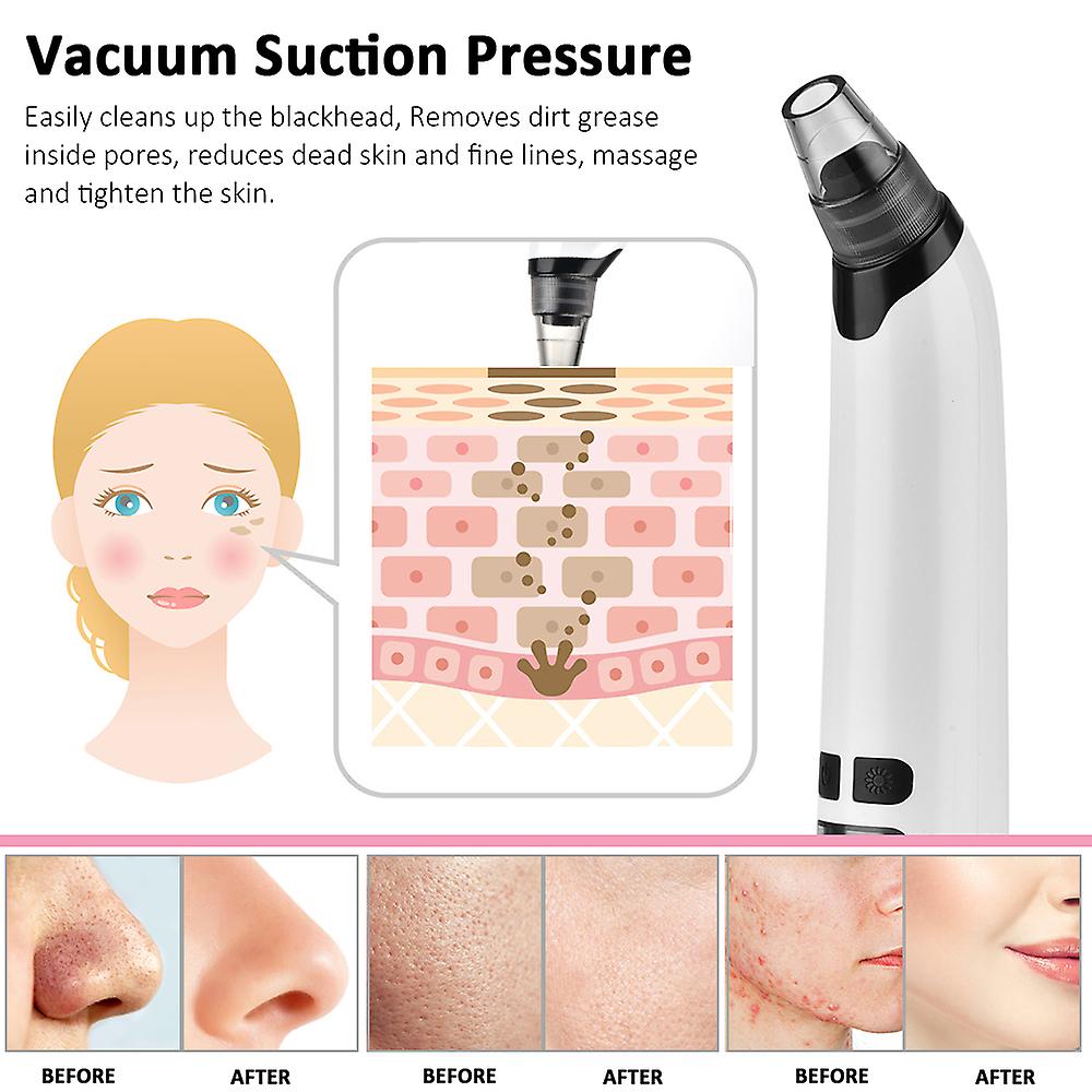 a diagram of how to use a vacuum for acne