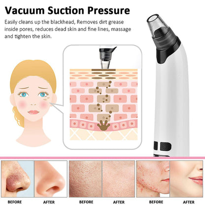 a diagram of how to use a vacuum for acne