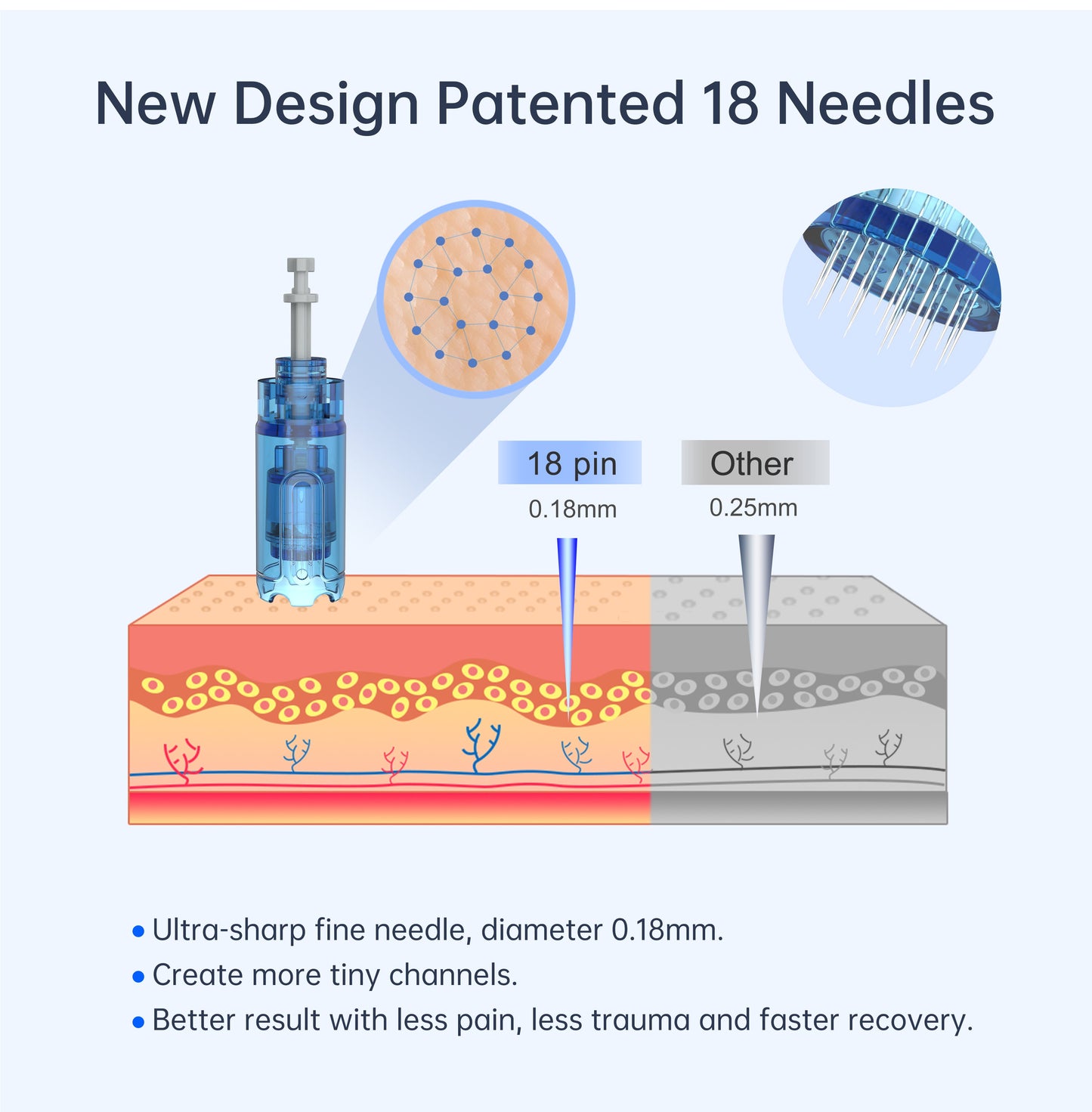 a diagram of a new design patterned 18 needles