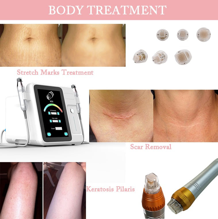 Portable Micro Needling Radio Frequency Mnrf Machine