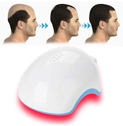 SD Cosmetics Care Portable Laser Hair Growth Helmet