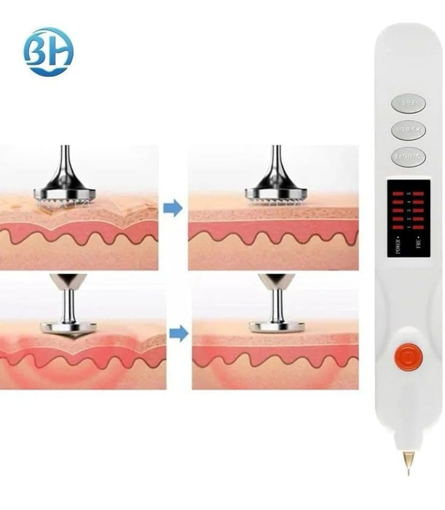 Modern Aesthetics Fibroblast Plasma Pen For Face Eyelid Lift Wrinkle Removal Spot removal Plasma pen