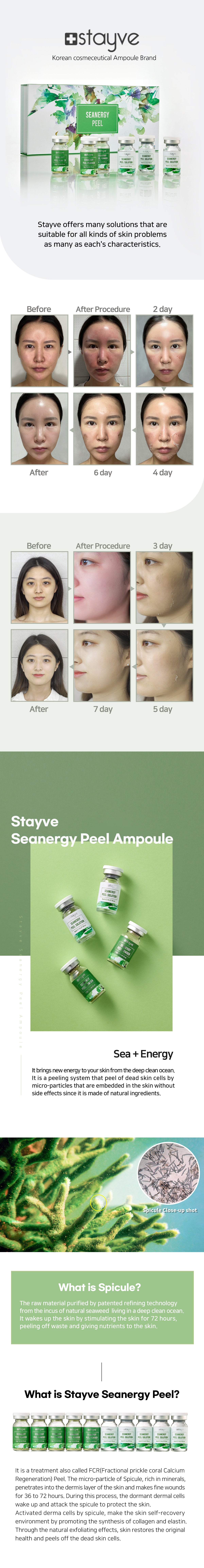 STAYVE SEANERGY PEEL KIT