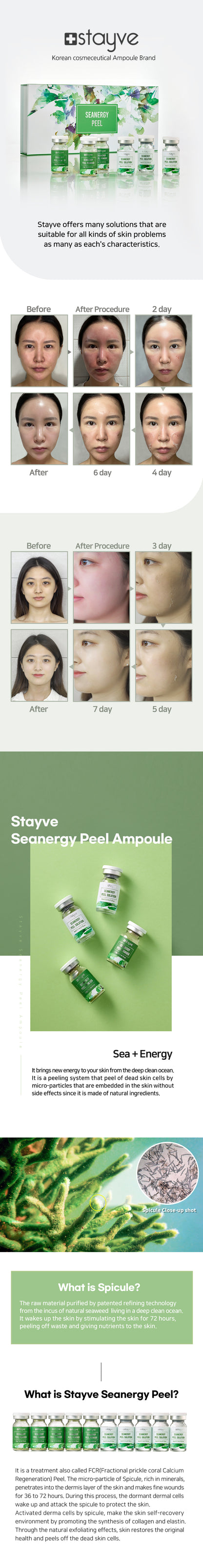 STAYVE SEANERGY PEEL KIT