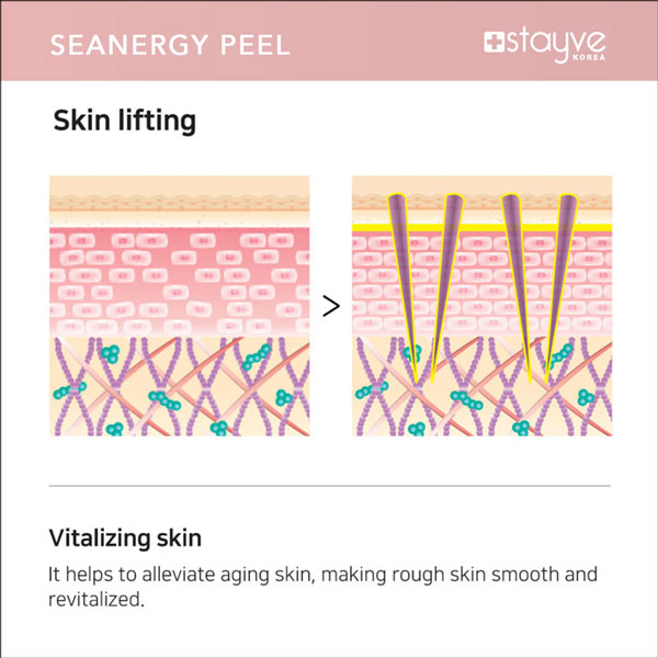 STAYVE SEANERGY PEEL KIT